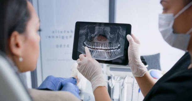 Licensed Teeth Whitening service in Josephine, TX - Smile Center Dentistry